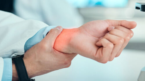 A imagem mostra uma pessoa de jaleco branco, provavelmente um profissional da área da saúde ou de laboratório, segurando o próprio punho com a outra mão. A região do punho está destacada em vermelho, sugerindo dor, inflamação ou lesão. Ao fundo, aparecem equipamentos de laboratório, indicando um ambiente de trabalho científico ou hospitalar. A cena remete a um possível acidente de trabalho ou a uma condição ocupacional relacionada a esforço repetitivo.